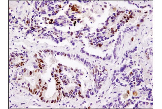 Immunohistochemistry Image 1: DAX1 (D2F1) Rabbit mAb