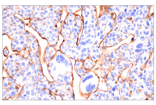 Immunohistochemistry Image 2: CD38 (E9F5A) XP<sup>®</sup> Rabbit mAb