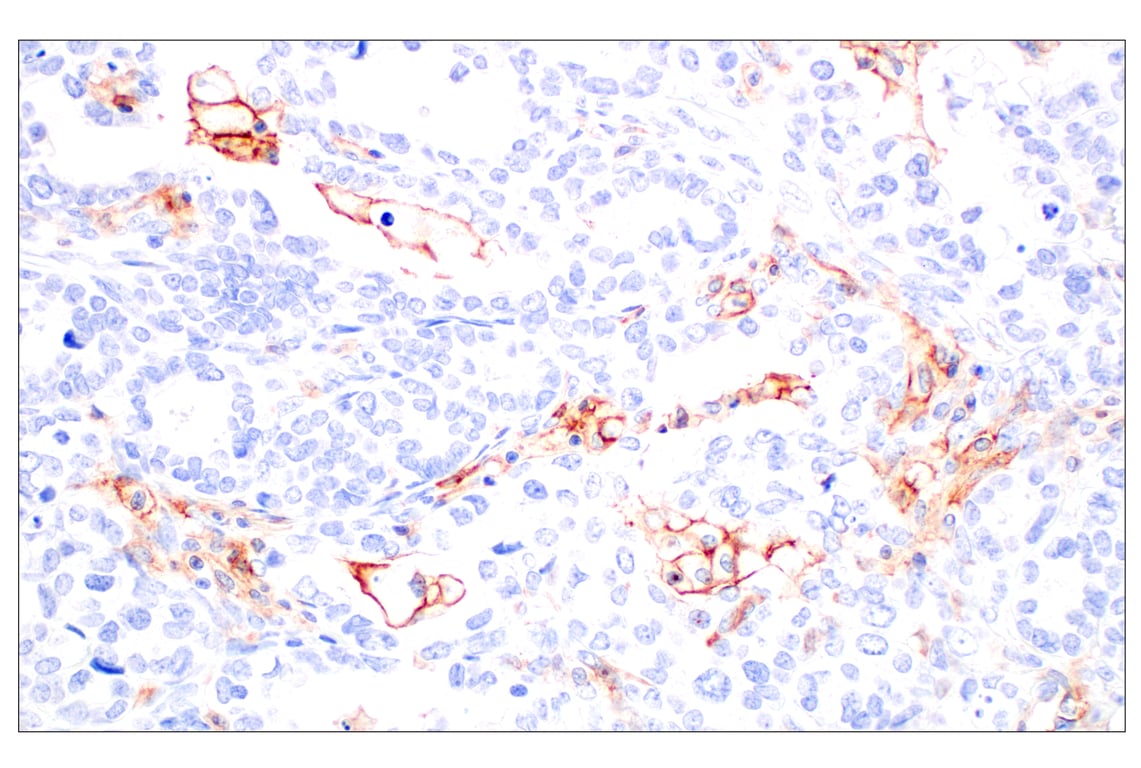 Immunohistochemistry Image 8: CD11b/ITGAM (E3J2F) Rabbit mAb