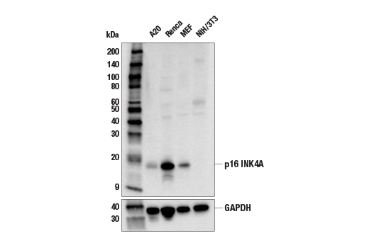 Western Blotting Image 3: p16 INK4A (E5F3Y) Rabbit mAb