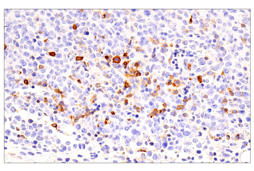 Immunohistochemistry Image 4: ICOS (E5F7E) Rabbit mAb (BSA and Azide Free)