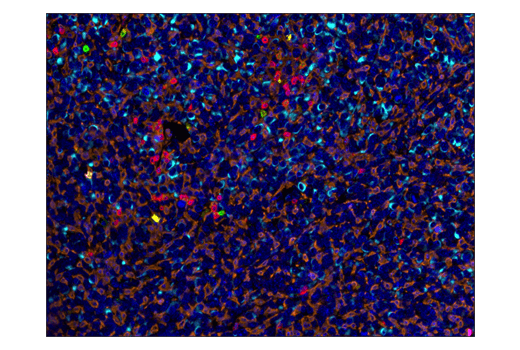 Immunohistochemistry Image 4: CD3ε (D4V8L) Rabbit mAb (BSA and Azide Free)