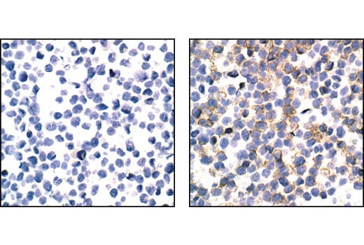 Immunohistochemistry Image 1: Phospho-CSF-1R/M-CSF-R (Tyr723) (49C10) Rabbit mAb