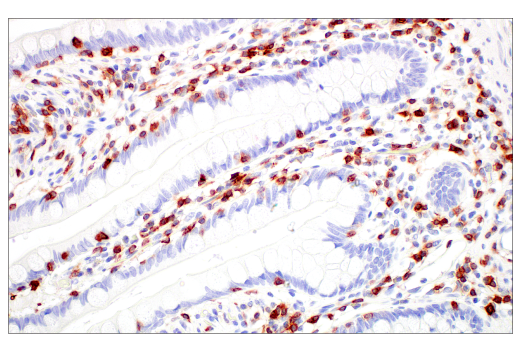 Immunohistochemistry Image 2: CD7 (E4G1Q) XP<sup>®</sup> Rabbit mAb (BSA and Azide Free)