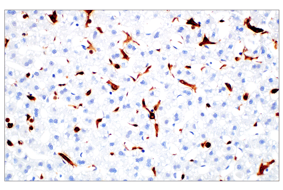 Immunohistochemistry Image 11: Iba1/AIF-1 (E4O4W) XP<sup>®</sup> Rabbit mAb (BSA and Azide Free)