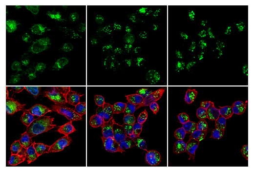 Immunofluorescence Image 2: LC3B (E7X4S) XP<sup>®</sup> Rabbit mAb