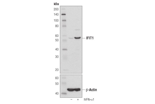 Western Blotting Image 1: IFIT1 (D2X9Z) Rabbit mAb