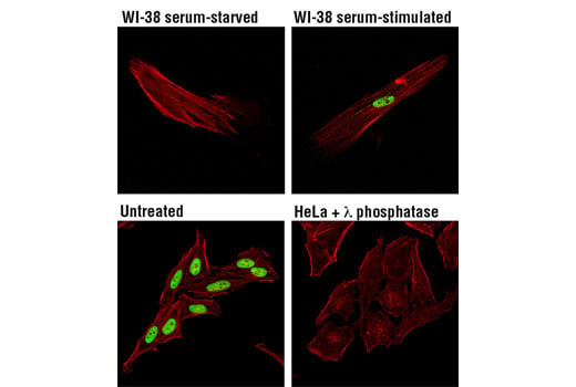 Immunofluorescence Image 1: Phospho-MCM2 (Ser139) (D1Z8X) XP<sup>®</sup> Rabbit mAb (BSA and Azide Free)