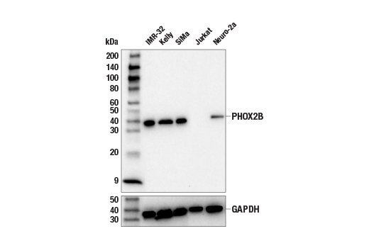 Western Blotting Image 1: PHOX2B Antibody