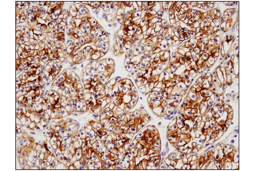 Immunohistochemistry Image 1: TIM-3 (D5D5R<sup>™</sup>) XP<sup>®</sup> Rabbit mAb (BSA and Azide Free)