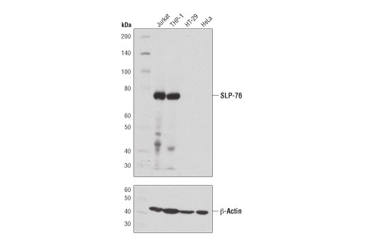 Western Blotting Image 1: SLP-76 (D1R1A) Rabbit mAb