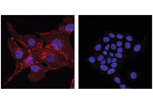 Immunofluorescence Image 1: N-Cadherin (D4R1H) XP<sup>®</sup> Rabbit mAb (Alexa Fluor<sup>®</sup> 647 Conjugate)