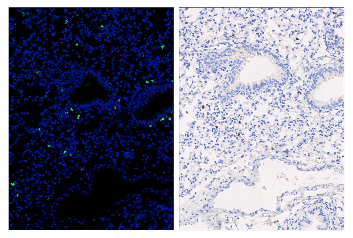 Immunohistochemistry Image 6: CD8α (D4W2Z) & CO-0040-488 SignalStar<sup>™</sup> Oligo-Antibody Pair