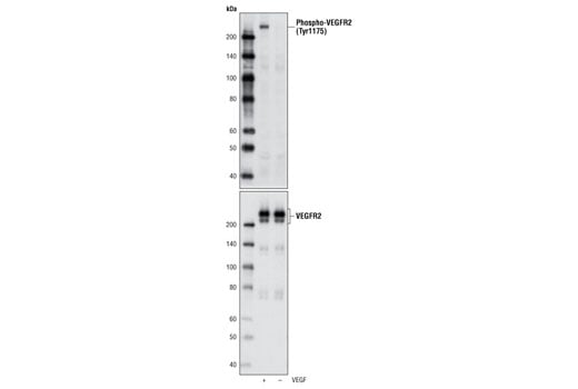 Western Blotting Image 1: Phospho-VEGF Receptor 2 (Tyr1175) (D5B11) Rabbit mAb