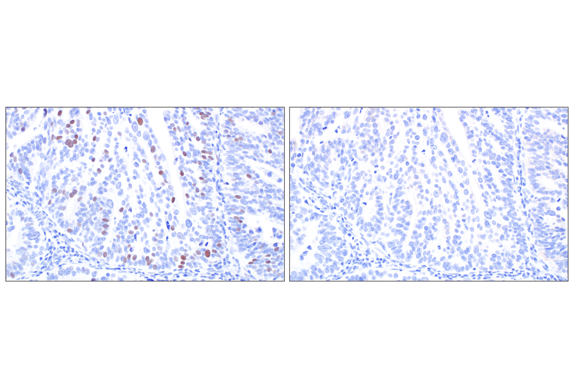 Immunohistochemistry Image 7: MASTL (F7I2C) Rabbit mAb