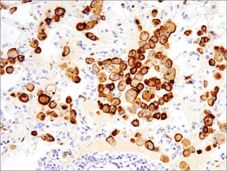 Immunohistochemical analysis of paraffin-embedded spleen using FoxP3 (D6O8R) Rabbit mAb