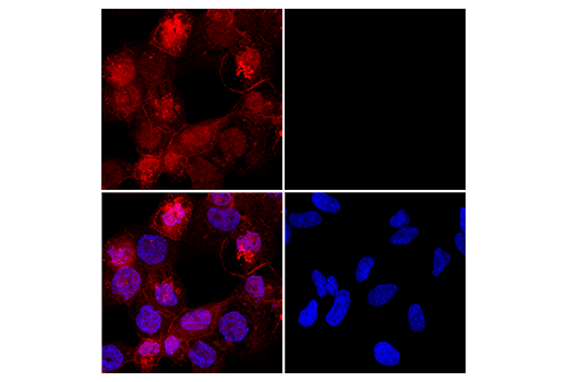 Immunofluorescence Image 1: Iba1/AIF-1 (E4O4W) XP<sup>®</sup>  Rabbit mAb (Alexa Fluor<sup>®</sup> 647 Conjugate)