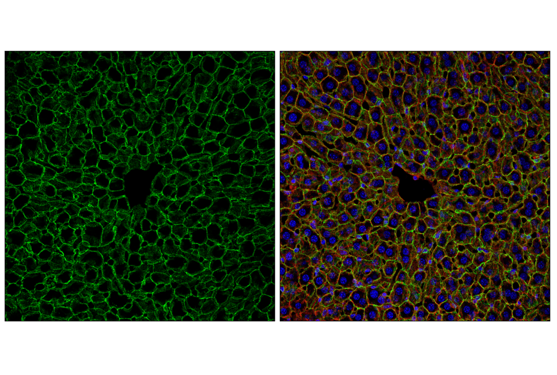 Immunofluorescence Image 1: N-Cadherin (D4R1H) XP<sup>®</sup> Rabbit mAb
