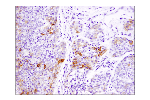 Immunohistochemistry Image 5: B7-H4 (D1M8I) XP<sup>®</sup> Rabbit mAb (BSA and Azide Free)