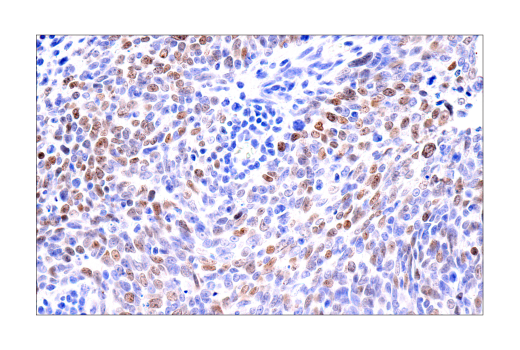 Immunohistochemistry Image 2: ATAD2 (E8Y7F) Rabbit mAb