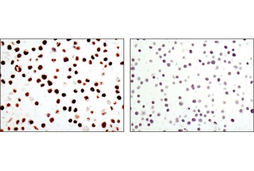 Immunohistochemistry Image 2: C/EBPα (D56F10) XP<sup>®</sup> Rabbit mAb (BSA and Azide Free)