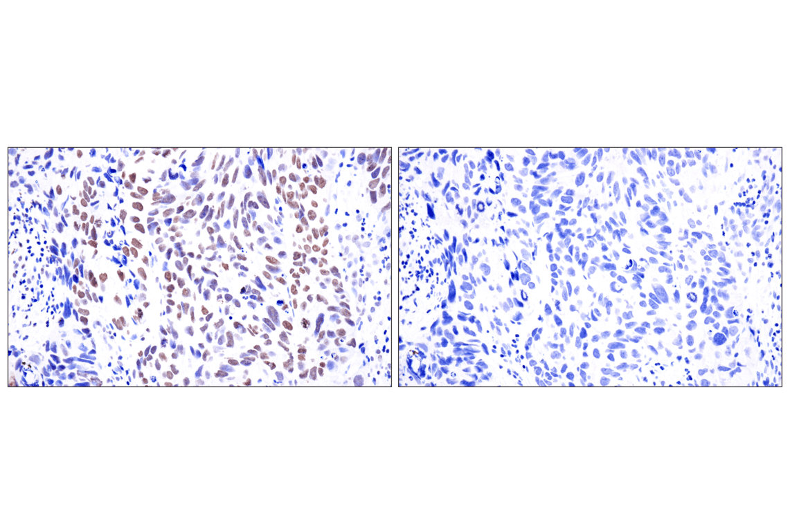 Immunohistochemistry Image 8: Acetyl-Histone H4 (Lys16) (E2B8W) Rabbit mAb