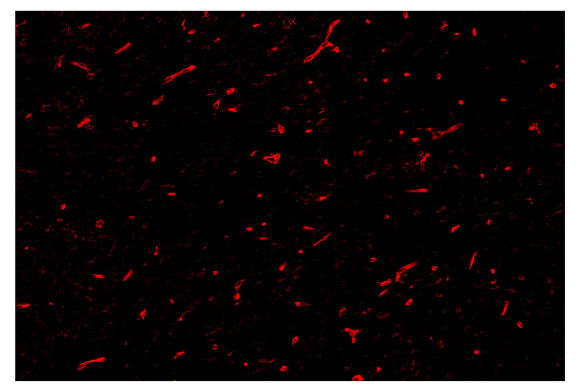 Immunohistochemistry Image 4: CD141/Thrombomodulin (E7Y9P) & CO-0088-647 SignalStar<sup>™</sup> Oligo-Antibody Pair