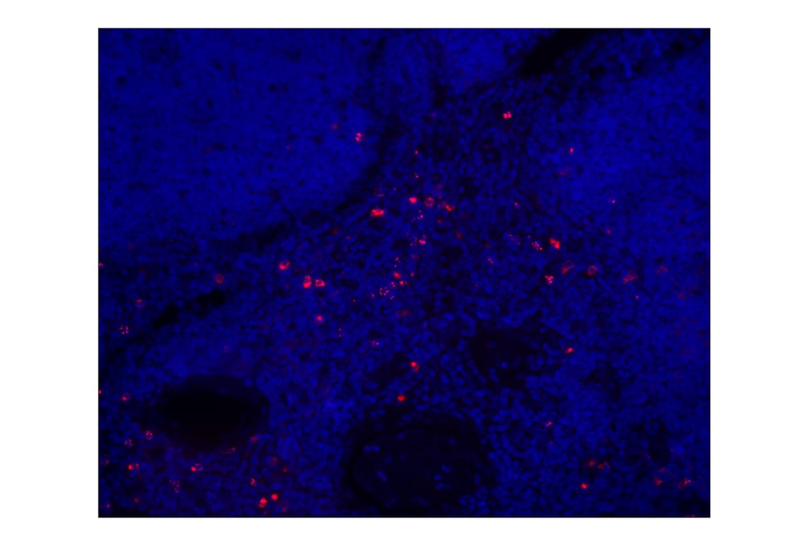 Immunohistochemistry Image 1: Granzyme B (D6E9W) Rabbit mAb (Alexa Fluor® 647 Conjugate)