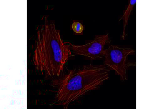 undefined Image 10: Aurora Antibody Sampler Kit