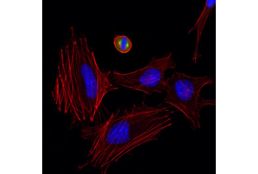 undefined Image 10: Aurora Antibody Sampler Kit