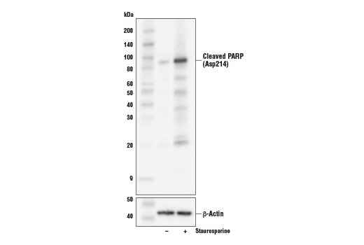 undefined Image 16: Tau Mouse Model Neuronal Viability IF Antibody Sampler Kit