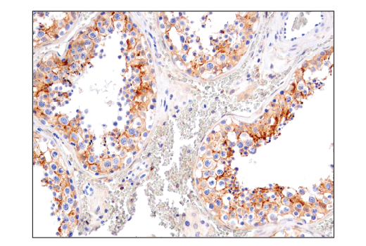 Immunohistochemistry Image 9: Notch2 (D76A6) XP<sup>®</sup> Rabbit mAb (BSA and Azide Free)