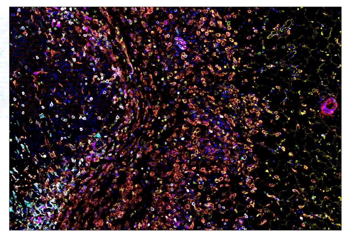 Immunohistochemistry Image 7: Pan-Keratin (Type I) (E6S1S) & CO-0072-594 SignalStar<sup>™</sup> Oligo-Antibody Pair