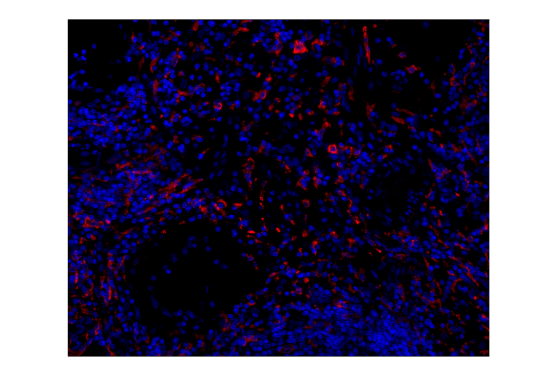 Immunohistochemistry Image 1: CD163 (D6U1J) Rabbit mAb (Alexa Fluor<sup>®</sup> 555 Conjugate)