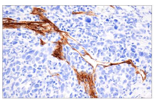 Immunohistochemistry Image 2: CD62P/P-Selectin (E8Q1W) XP<sup>®</sup> Rabbit mAb (BSA and Azide Free)