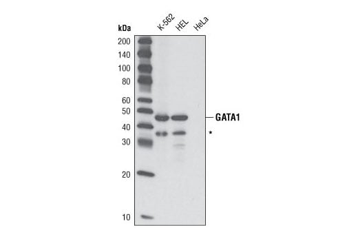 Western Blotting Image 1: GATA-1 (D24E4) XP<sup>®</sup> Rabbit mAb