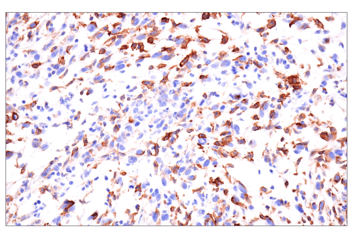 Immunohistochemistry Image 2: CD22 (F9D1W) Rabbit mAb (BSA and Azide Free)