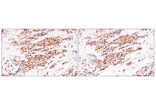 Immunohistochemistry Image 5: Cyclin D1 (E3P5S) XP<sup>®</sup> Rabbit mAb (BSA and Azide Free)