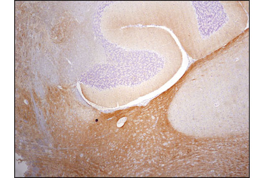 Immunohistochemistry Image 3: Phospho-Tau (Thr181) (D9F4G) Rabbit mAb (BSA and Azide Free)