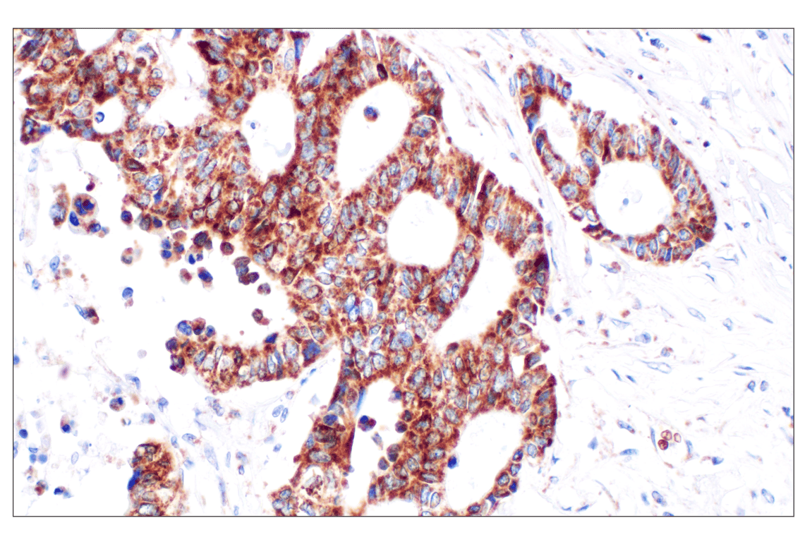 undefined Image 32: Cell Fractionation Antibody Sampler Kit
