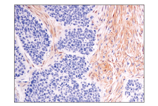 Immunohistochemistry Image 4: Notch2 (D76A6) XP<sup>®</sup> Rabbit mAb (BSA and Azide Free)