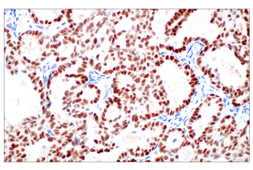 Immunohistochemistry Image 2: POU2F3 (E5N2D) XP<sup>®</sup> Rabbit mAb