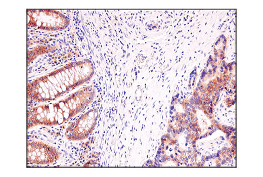 undefined Image 18: Glutamine Metabolism Antibody Sampler Kit