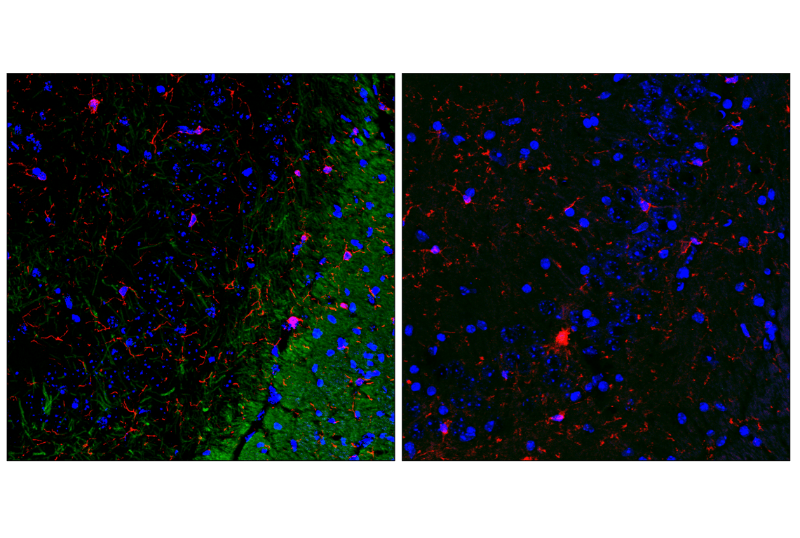 undefined Image 13: Demyelinating Disease Targets Antibody Sampler Kit