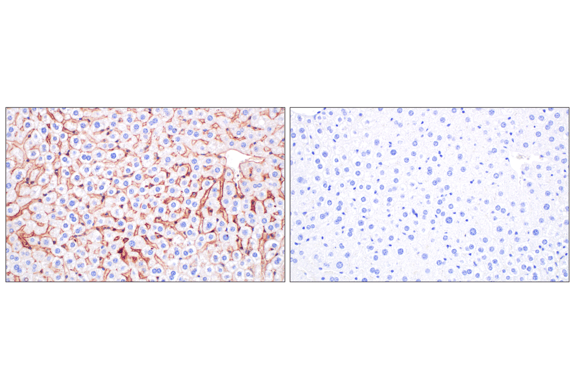 Immunohistochemistry Image 7: PNPLA3 (E7N6O) Rabbit mAb (BSA and Azide Free)