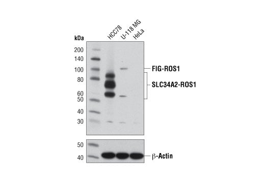 Western Blotting Image 1: ROS1 (D4D6<sup>®</sup>) Rabbit mAb