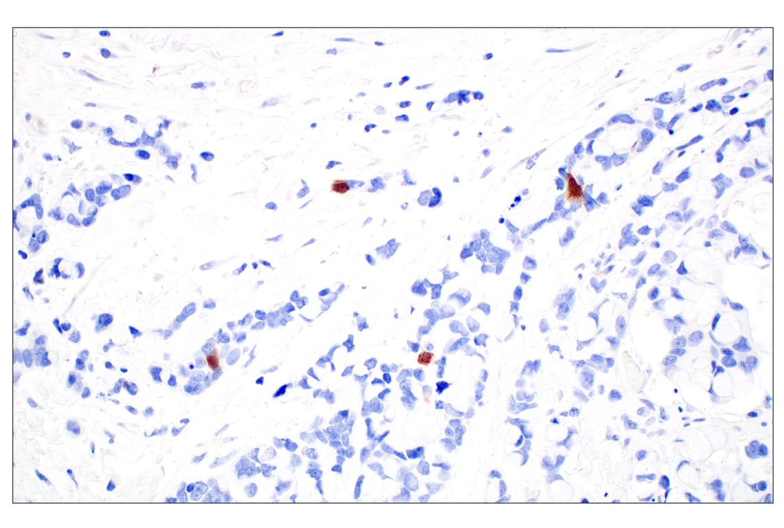 Immunohistochemistry Image 4: OCA-T1 (E4T1K) Rabbit mAb (BSA and Azide Free)