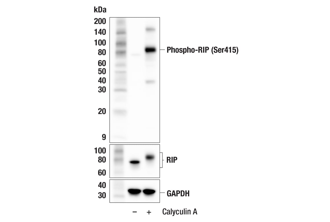 Western Blotting Image 3: Phospho-RIP (Ser415) (F1U7B) Rabbit mAb