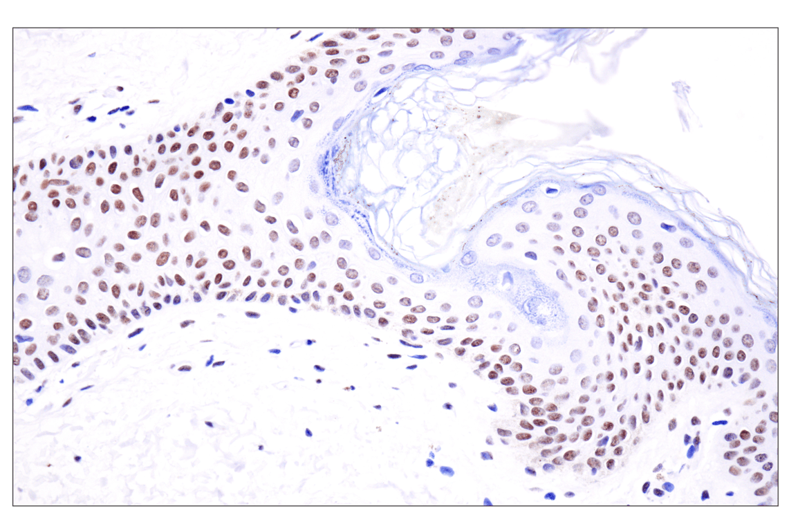 Immunohistochemistry Image 5: Acetyl-Histone H4 (Lys16) (E2B8W) Rabbit mAb
