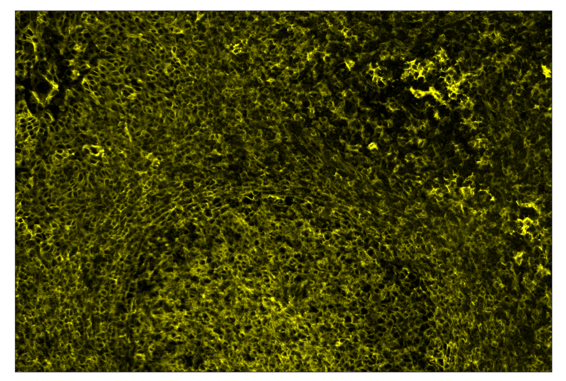 Immunohistochemistry Image 2: CD40 (D8W3N) & CO-0115-647 SignalStar<sup>™</sup> Oligo-Antibody Pair